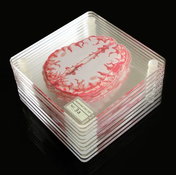 Acrylic Glass Brain Specimen Drink Coasters Set - 3D Horizontal Plane Slices - Psych Outlet